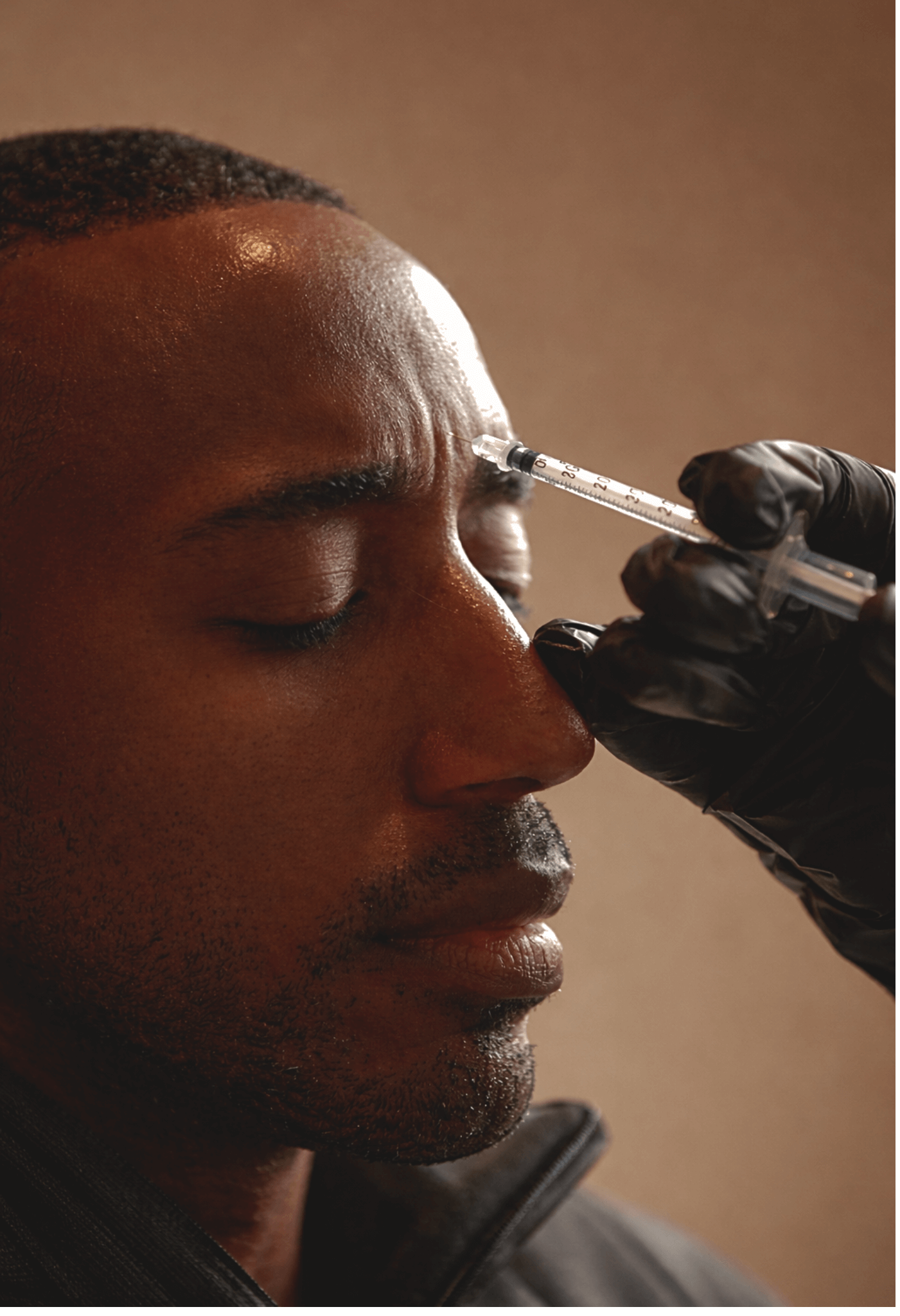 Traitement botox du front pour réduire les rides du visage