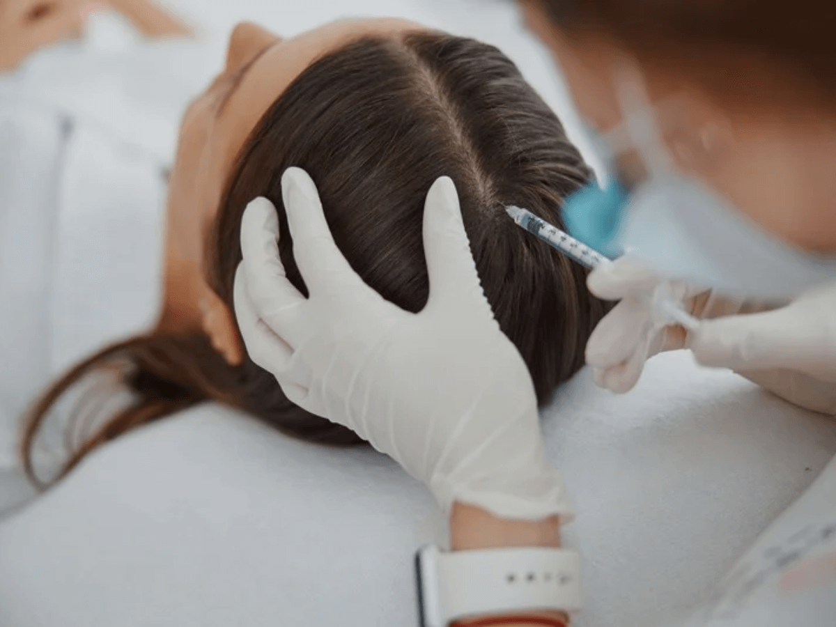 Mésothérapie capillaire pour stimuler la croissance des cheveux