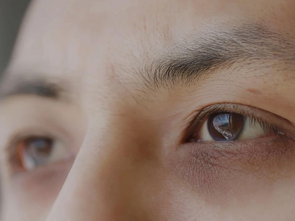 Soin esthétique des cernes chez l’homme pour un regard plus reposé